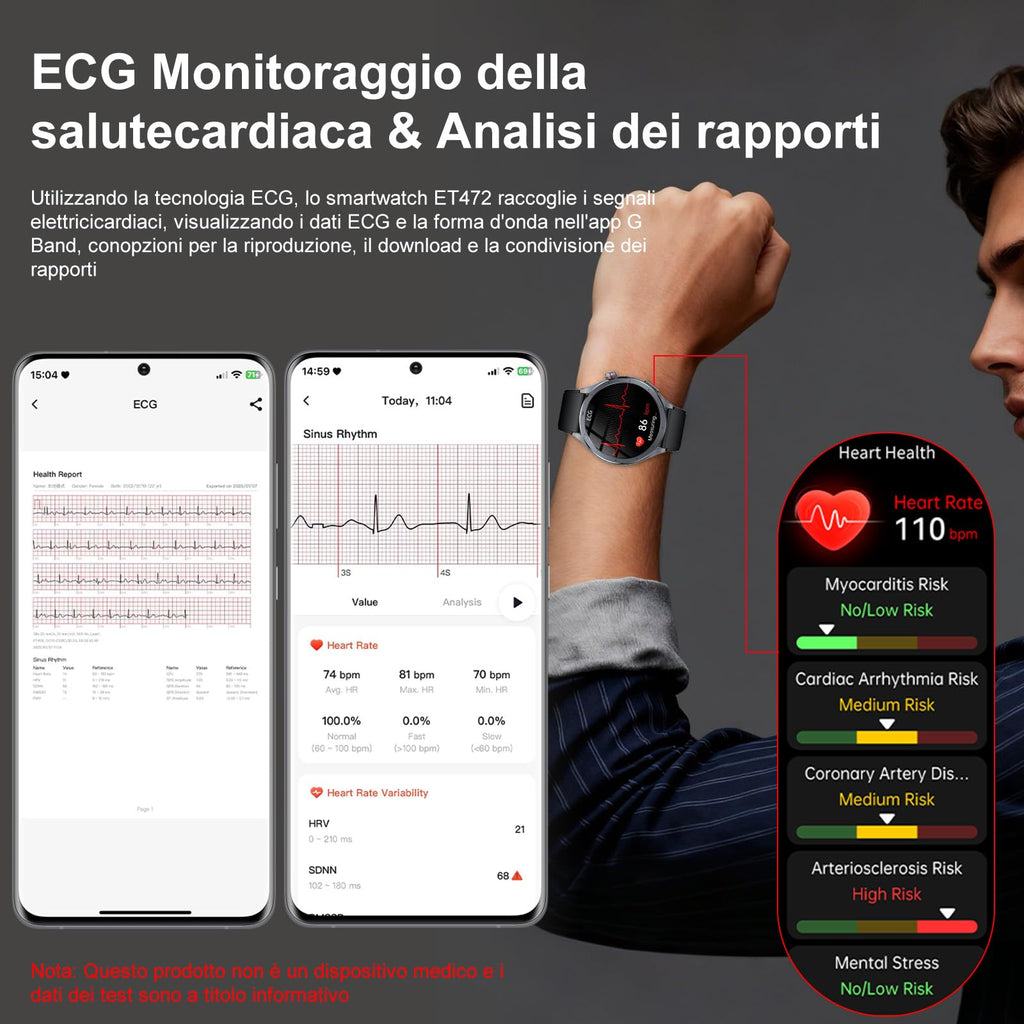 YUPENG 2026 Nuovo AI Smartwatch Uomo ChatGPT ECG/HRV/Lipidi/Acido Urico/BMI, 1.53" Orologio Fitness Chiamate/Torcia, 24H Pressione Sanguigna/Sonno/Temperatura/Cardiofrequenzimetro/SOS, Android iOS